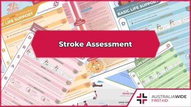Stroke Assessment Chart